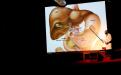 Anatomia di fegato, cistifellea e stomaco